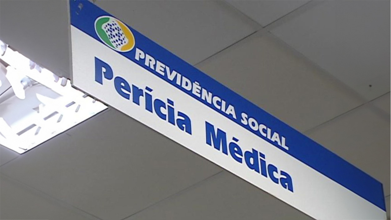 pericia do INSS